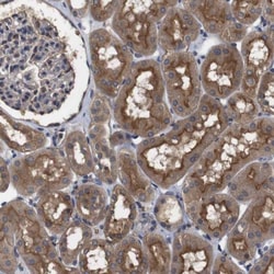 ARHGAP24 Antibody, Novus Biologicals 0.1mL; Unlabeled:Antibodies, Polyclonal
